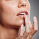 cold sore prevention